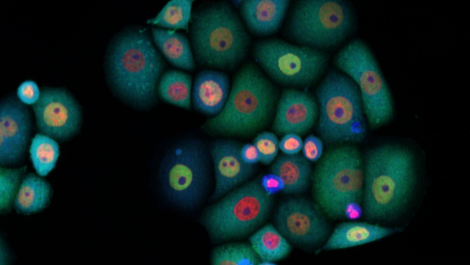 Immuno-oncology collaboration to develop innovative new type of cancer drug