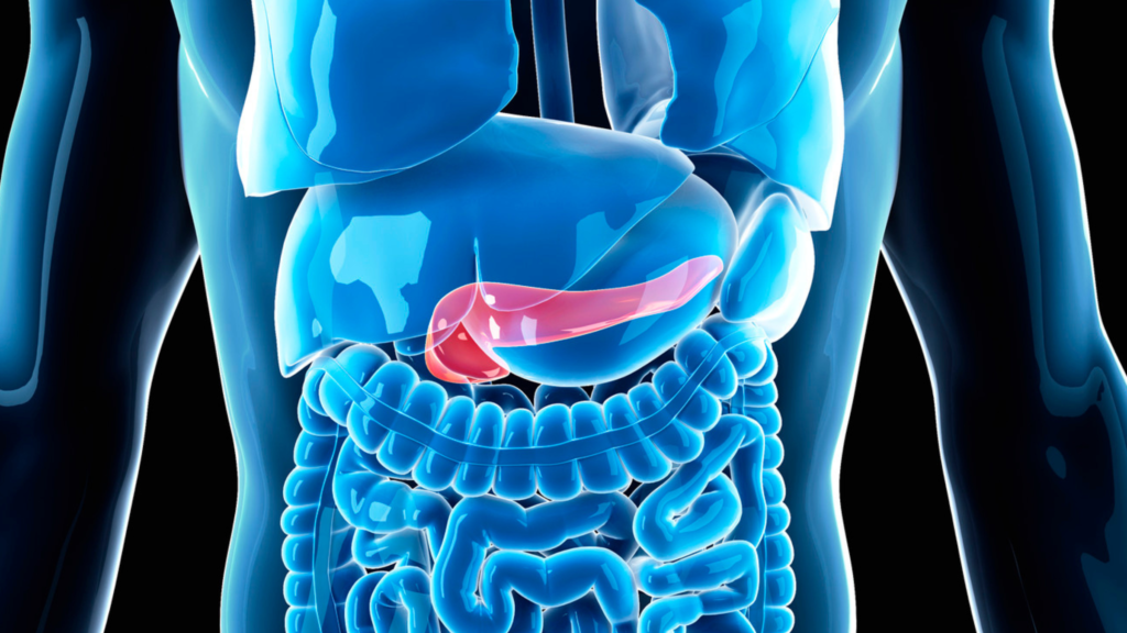 Study finds potential for treatment for pancreatic cancer using aggressive cells