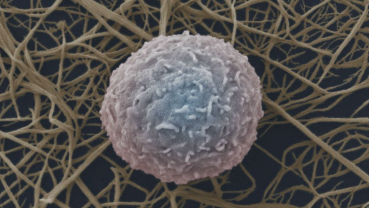 Image: white blood cell. Credit: Wellcome Images