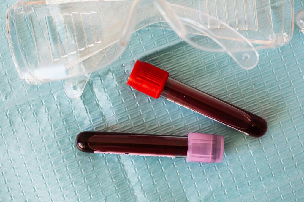 A major new UK study, led by The Christie NHS Foundation Trust and The University of Manchester, has been launched to help patients with cancer better tolerate cutting-edge immunotherapy treatments like CAR-T. It’s the first and largest programme of its kind ever established in the UK and is the culmination of 30 years of worldwide research.