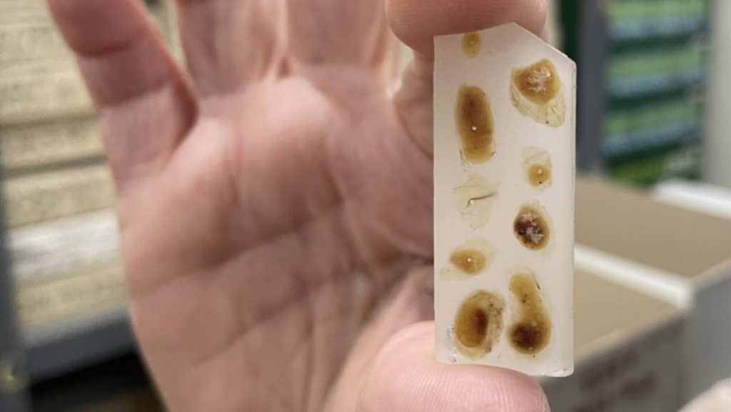 Tens of thousands of tumour samples which have been stored in the basement of a London hospital for more than 70 years could be the key to unlocking the mystery of why bowel cancer cases are rising in the under 50s, scientists believe.
