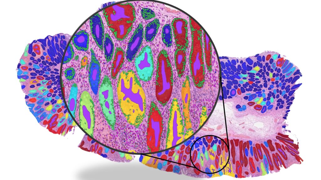 wsi_figure - Credit Dr Fayyaz Minhas_University of Warwick