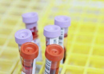 A £100,000 award from a charity founded by people affected by rare abdominal cancer is accelerating world-leading research at The Christie NHS Foundation Trust.