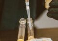 Cambridge scientists hunting tell-tale killer ‘zombie’ cells that signal early lung cancer have developed a world-first urine test that could transform diagnosis and survival for thousands of patients.
