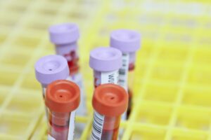 A research team working with The Clatterbridge Cancer Centre has been awarded more than £475,000 from Blood Cancer UK to continue and expand UNCOVER, one of the largest blood cancer data research programmes in the world.