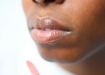 University College London Hospitals NHS Foundation Trust has become one of the first centres in the UK to introduce sentinel node biopsy (SNB) as a routine staging procedure for selected patients with early salivary gland cancer.
