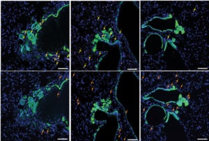 ImmuneFog_Figure 5E crop_reduced number of Tregs following treatment with PI3K-targetted drug with additional cells
