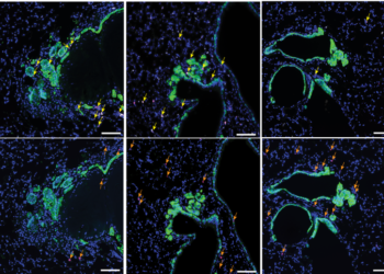ImmuneFog_Figure 5E crop_reduced number of Tregs following treatment with PI3K-targetted drug with additional cells