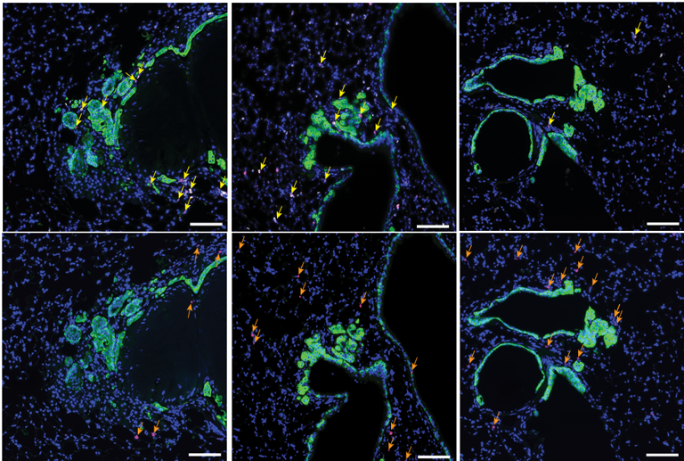 ImmuneFog_Figure 5E crop_reduced number of Tregs following treatment with PI3K-targetted drug with additional cells